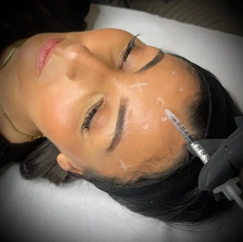 hydrafacial