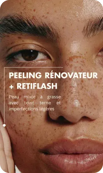 Illustration peeling