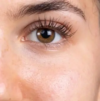 Peau lumineuse après un peeling - clinic 26