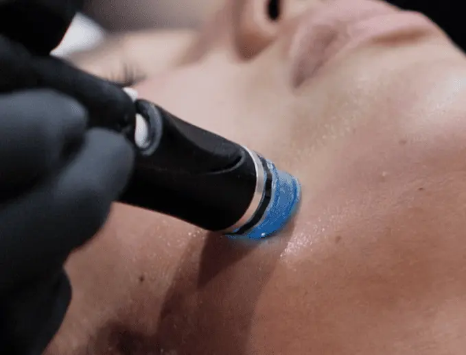 Le soin pour le visage Hydrafacial - Clinic 26