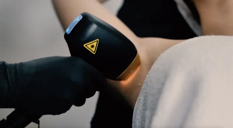 Épilation laser - Clinic 26